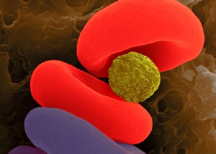 An injected gas-filled microparticle (yellow) can transfer oxygen molecules directly to red blood cells (red), bypassing the lungs to carry throughout the body.