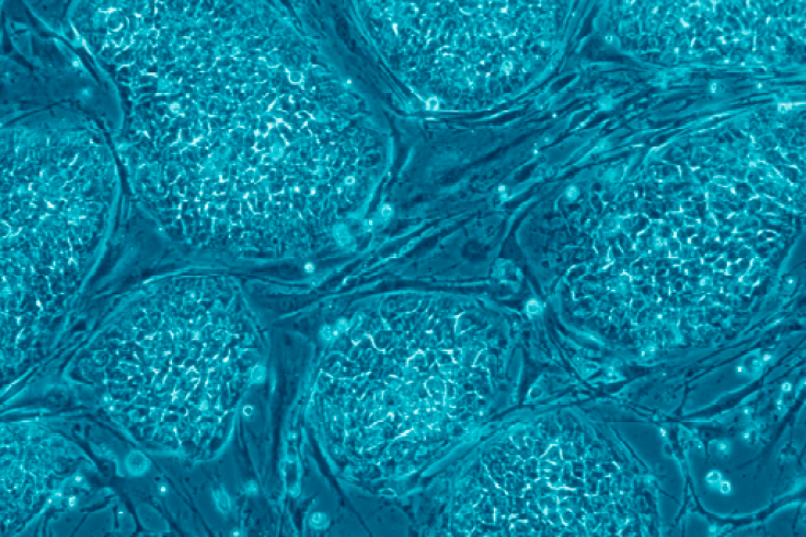 embryonic stem cells