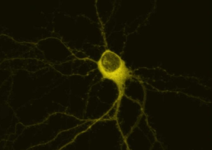 Shown here is a hippocampal neuron transfected with Yellow-Fluorescent Protein (YFP) tagged transglutaminase under control conditions.