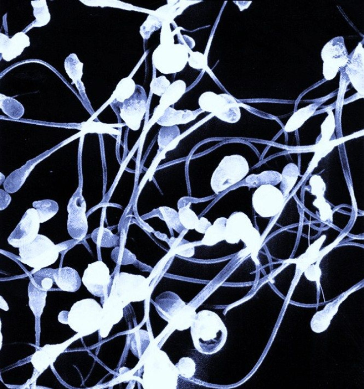 Scientists have sequenced the entire genomes of 91 human sperm from a 40-year-old man and revealed valuable insights into the infinite genetic variation that naturally occurs in a single individual.