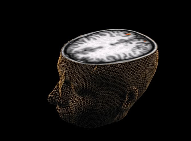 mind