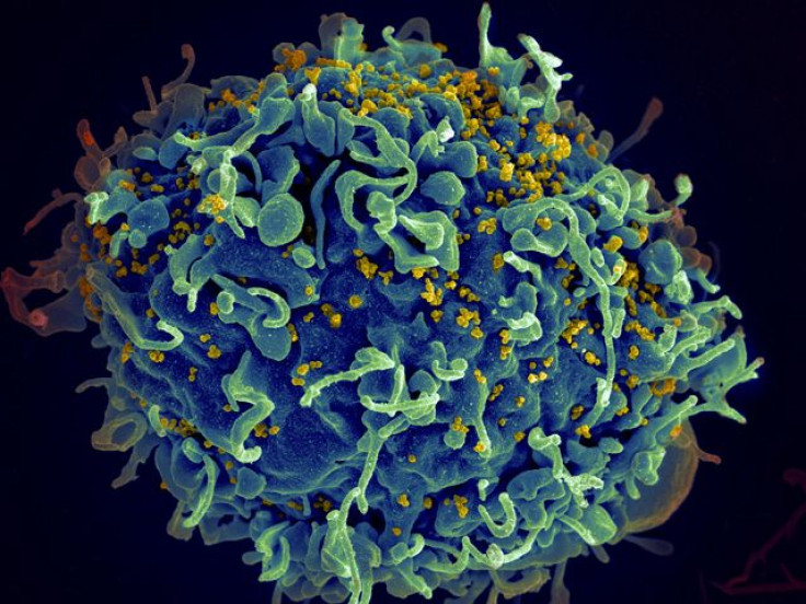 HIV particles infecting a human T cell