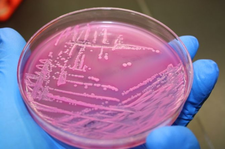 Strains of E. coli on a petri dish.