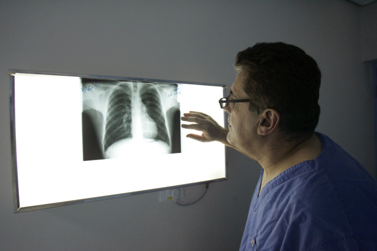 Doctor Looking at X-ray