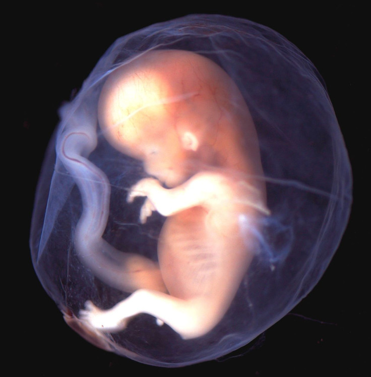 embryo