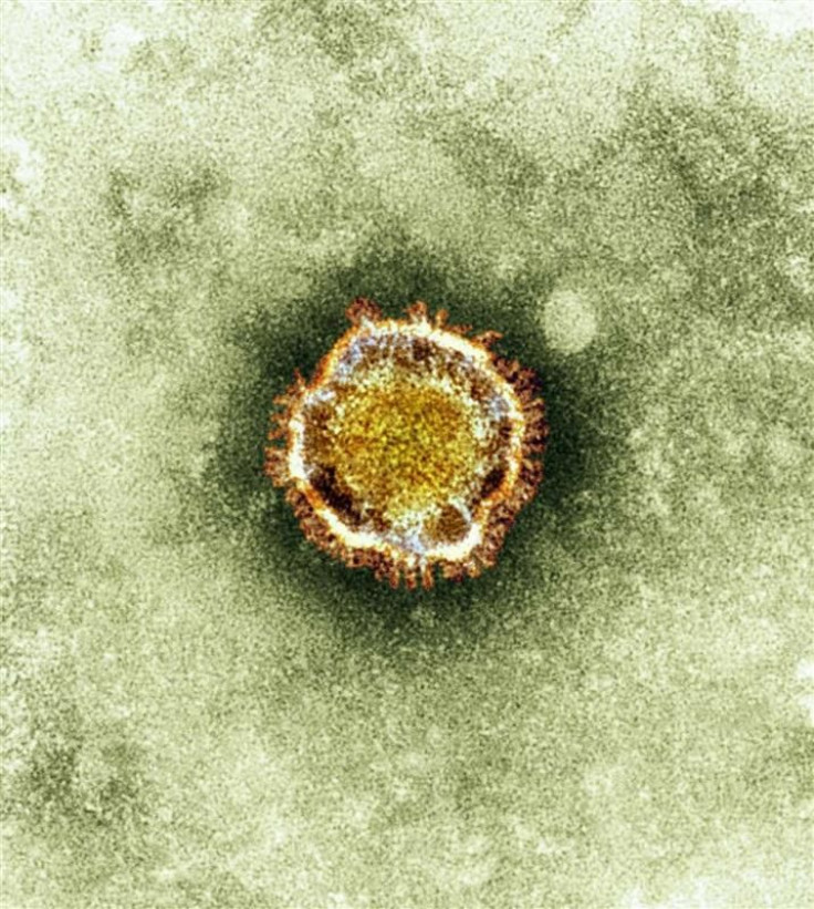 SARS virus