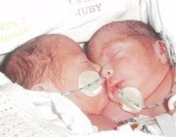 Rosie and Ruby Formosa