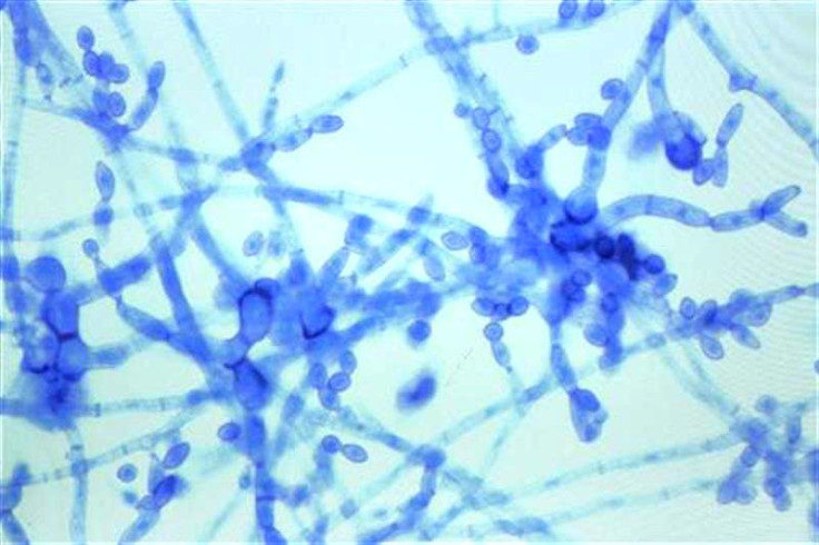 fungal meningitis, sample of Cladosporium species