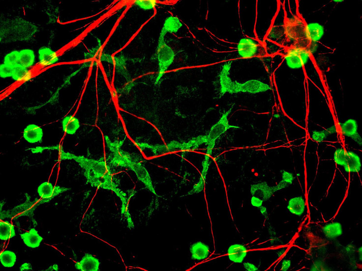 Microglia and neurons