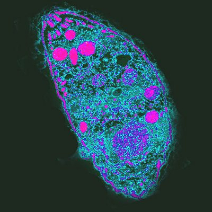 Toxoplasma gondii