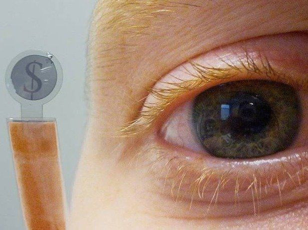 contacts