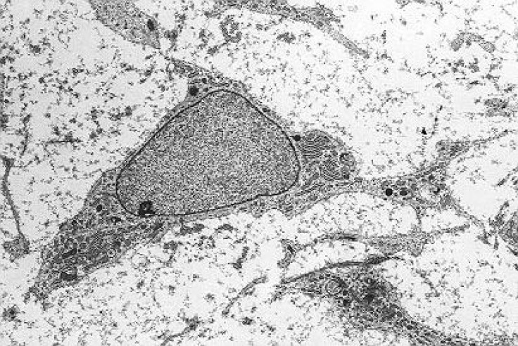 mesenchymal stem cells