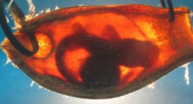 shark embryo