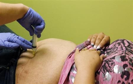 Gastric Bypass