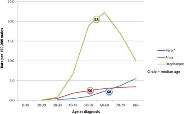 HPV Cancer Rates Affect Anal Cancers