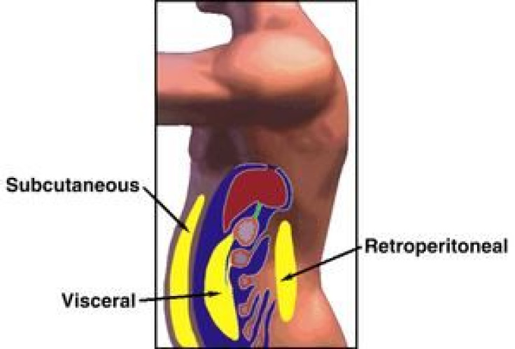 Weight Problems Sometimes Caused By Hormones