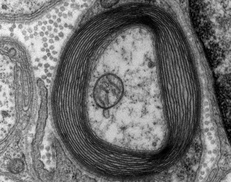 Myelinated Neuron