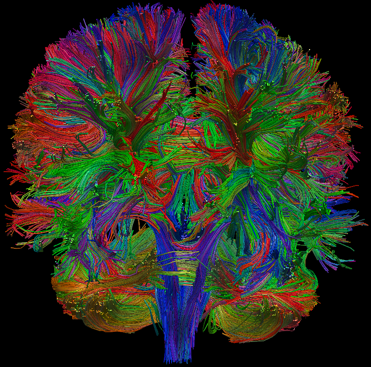 Diffusion Tensor Imaging 洋書
