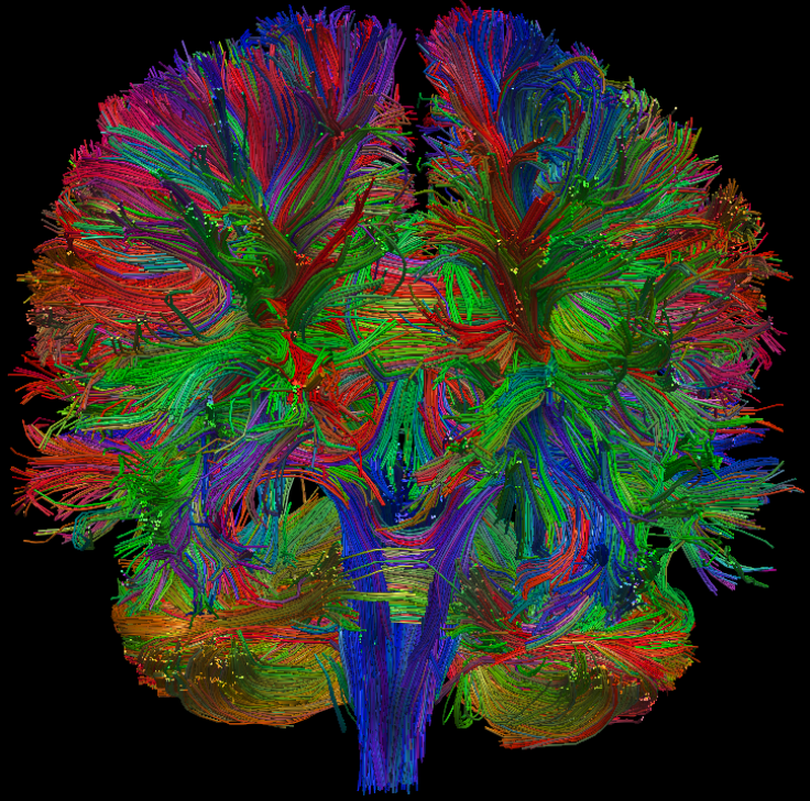 See-Through Brain Allows Researchers To Study Brain Disease [VIDEO]