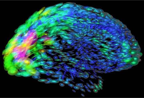 The U.S. Intends To Spend $100M Next Year To Begin Mapping The Human Brain