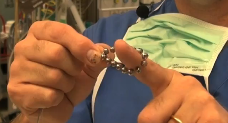 Bracelet device to precent acid reflux