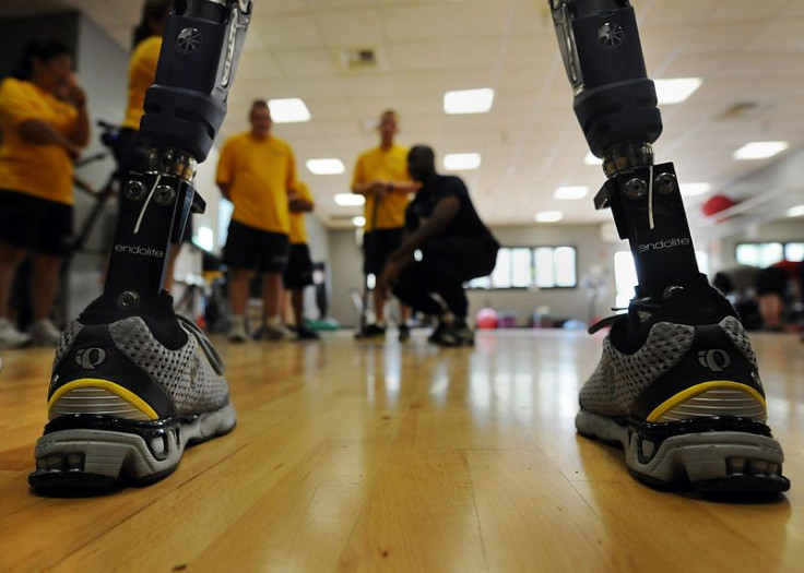 Advanced Prosthetic Technologies Aiding Amputees Of Boston Marathon Bombing