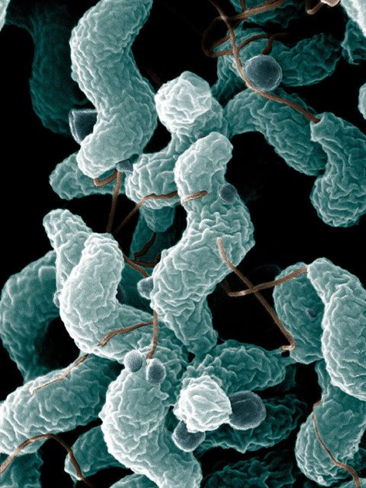 Microscopic image of Campylobacter bacteria