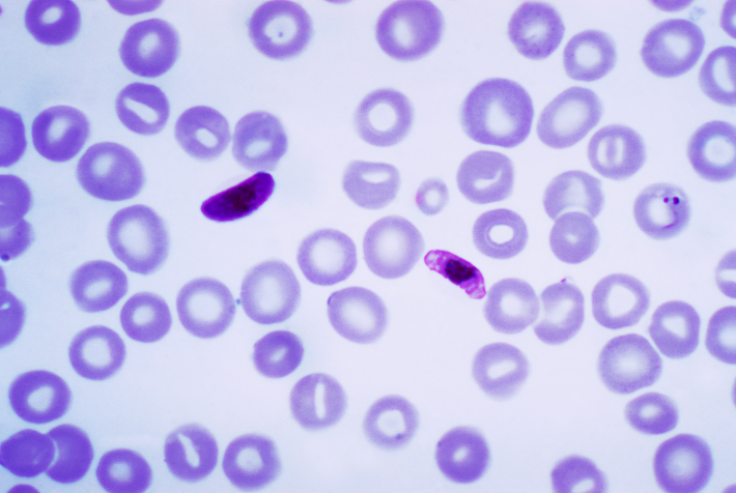 The Plasmodium falciparum parasite, seen under a microscope