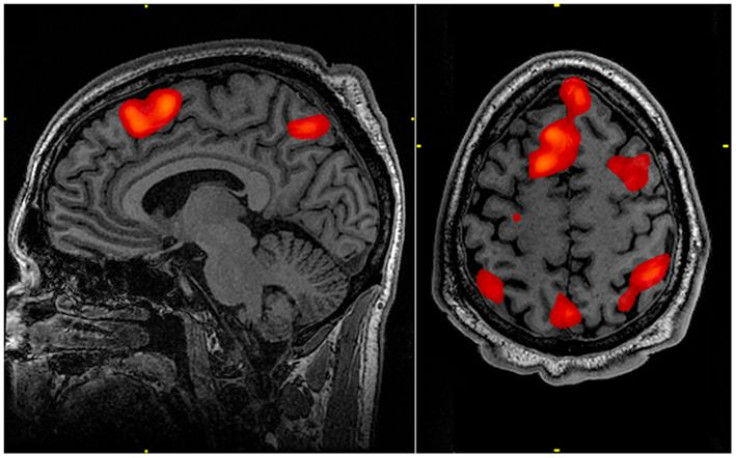 functional magnetic resonance imaging of brain doing memory tasks