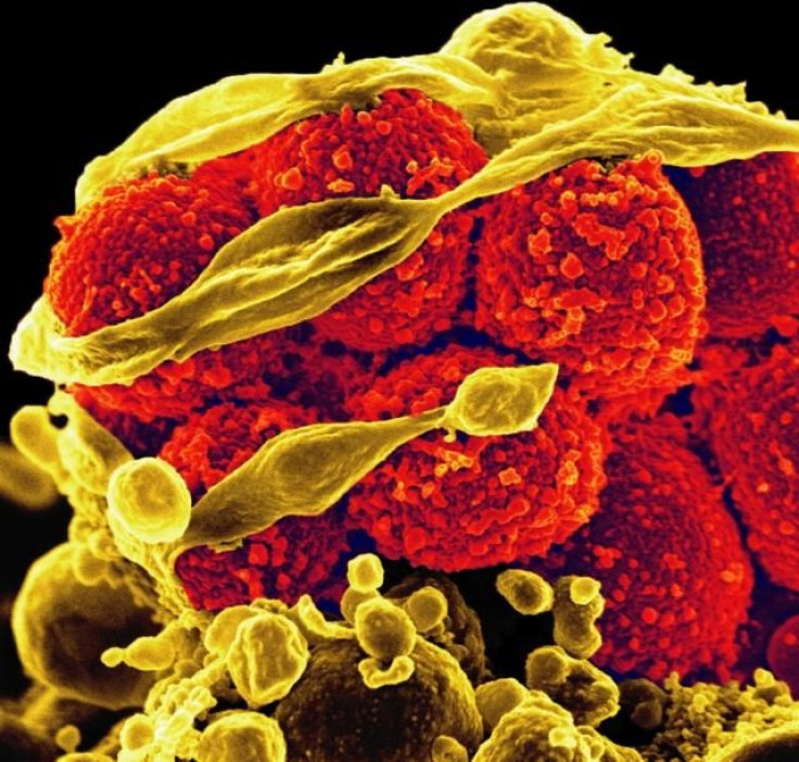 Scanning electron micrograph of methicillin-resistant Staphylococcus aureus bacteria (yellow, round items) killing and escaping from a human white cell.