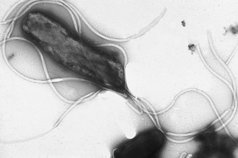 A new study shows there may be a link between variations in the TLR1 gene and infection by Helicobacter pylori.