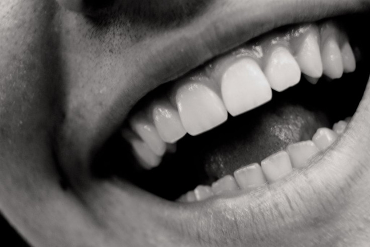 Laughter From Tickling, Social Cues Derive From Different But Overlapping Parts Of Brain
