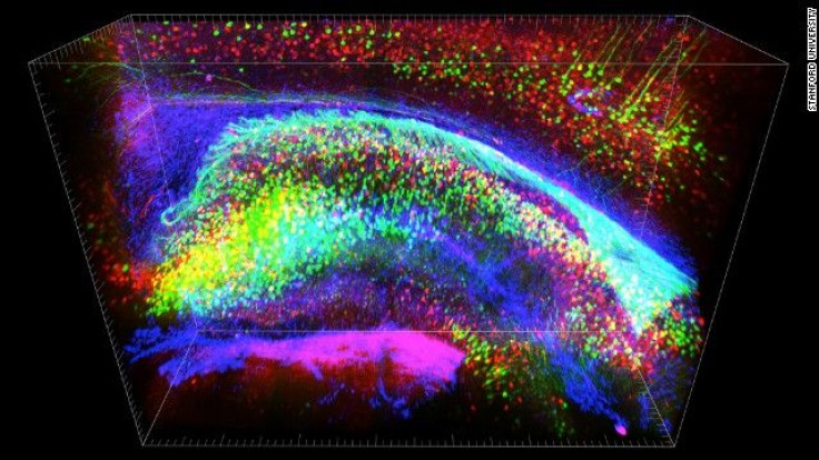 microchip brain implant memory