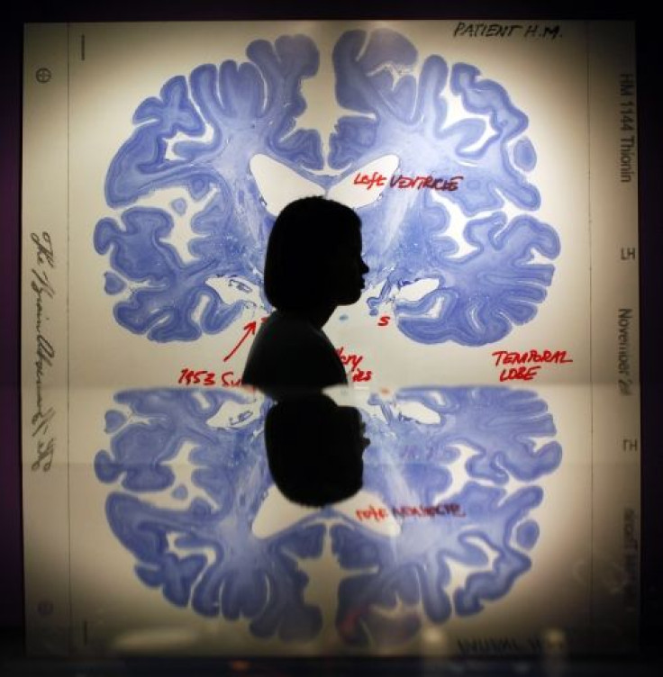 Human Brain Intelligence Frontal Lobe Size