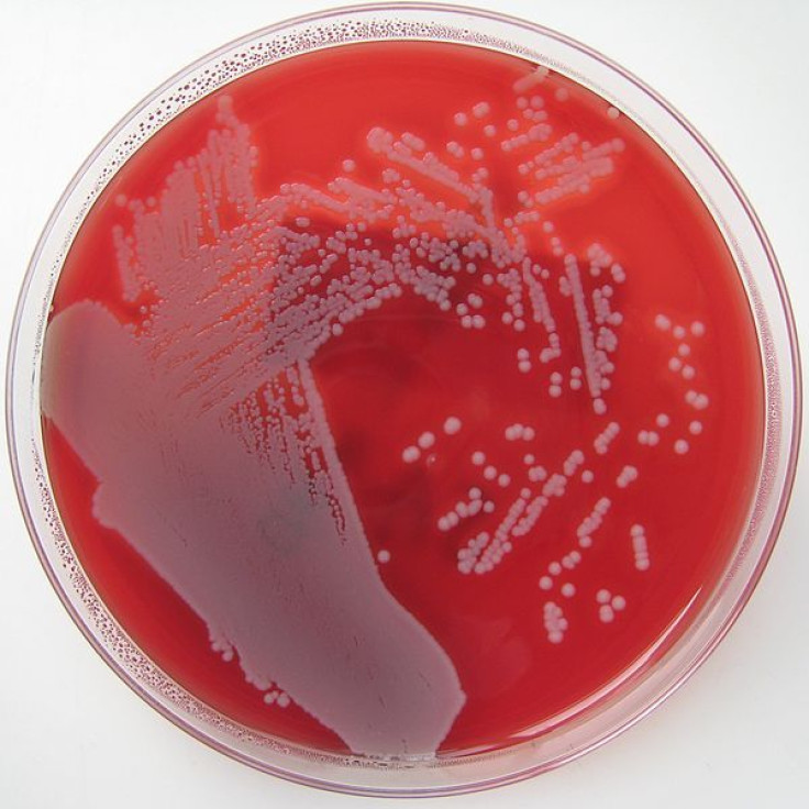 staphylococcus aureus