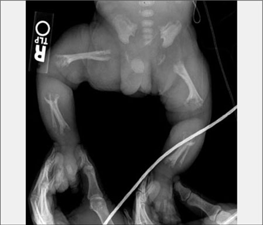 child xray