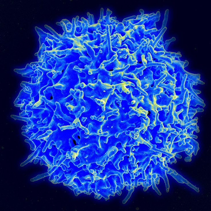 Scanning electron micrograph of a human T lymphocyte (also called a T cell) from the immune system of a healthy donor.