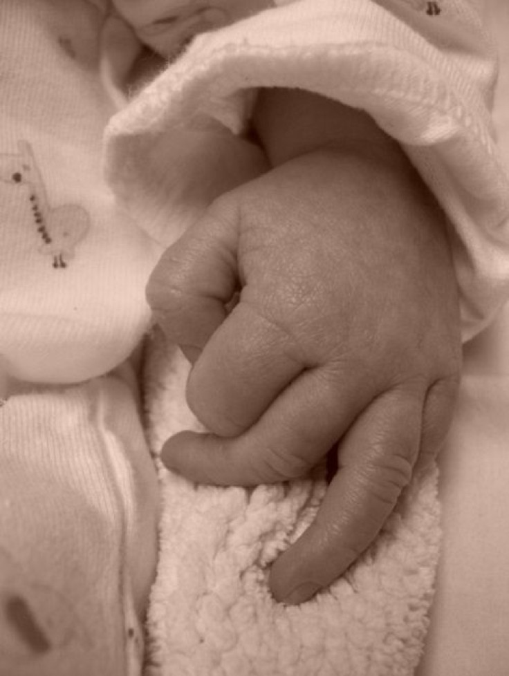 Infant Superglue Treatment:  Doctors Stop 3-Week-Old Baby's Brain Aneurysm in Breakthrough Procedure [Video]
