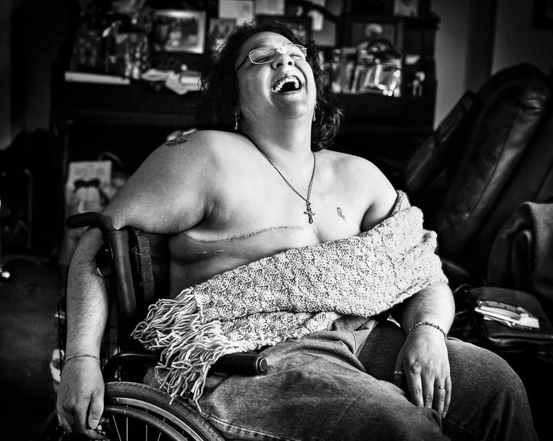 Facebook Mastectomy Photos of Breast Cancer Survivors