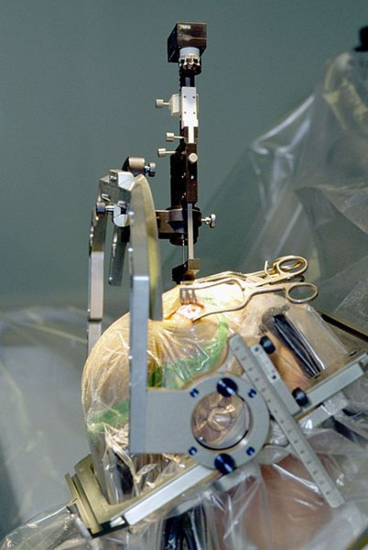 deep brain stimulation