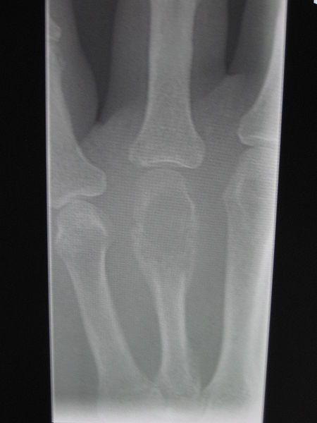 xray