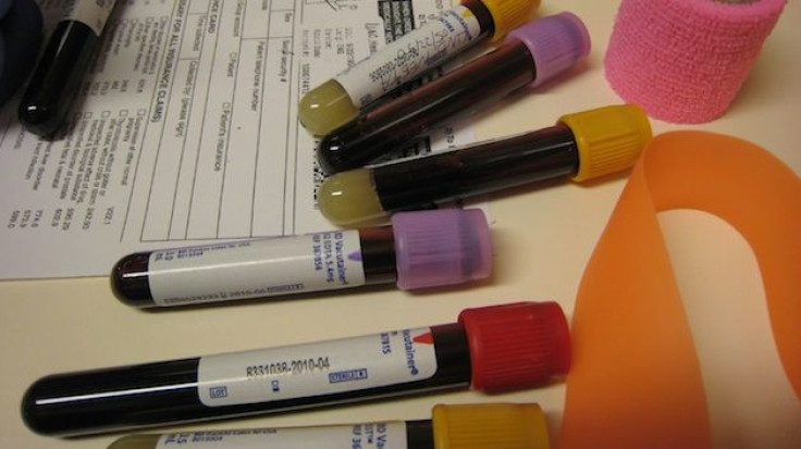 blood test and hpb