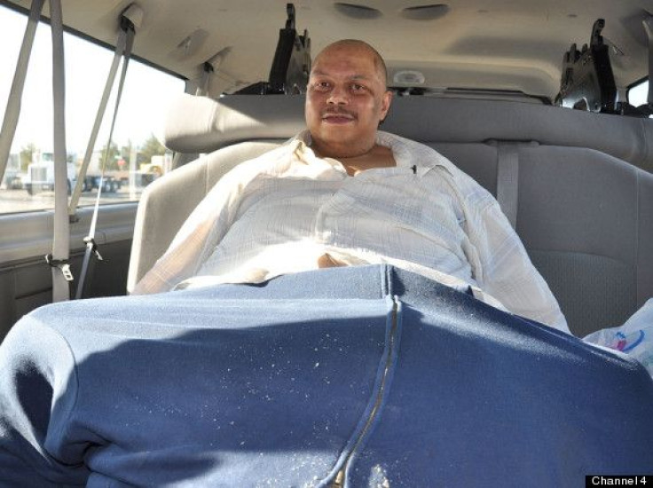 Man with 132 lb. Scrotum Is Left With One-Inch Penis