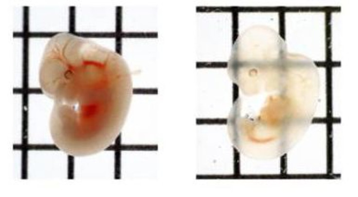 The Japanese institute RIKEN has developed a faster method for making brains and other bodily tissue transparent.