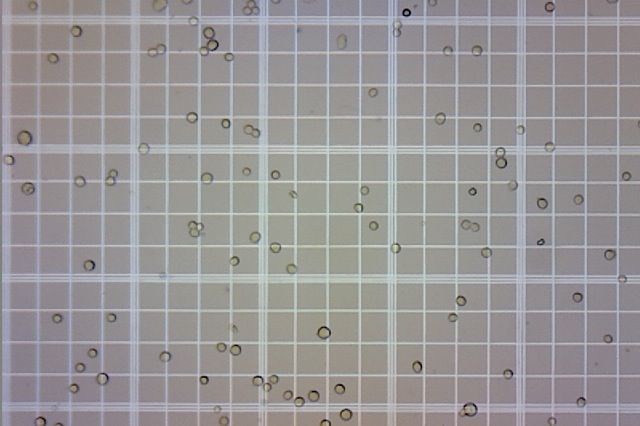 Cellular Movement Demystified, With Implications For Complex Disease