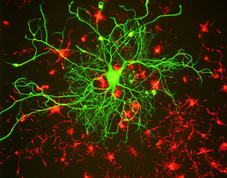 Neuron in MS