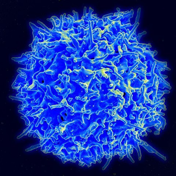 A human T lymphocyte