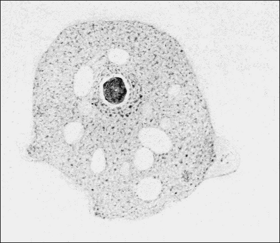 brain-eating-amoebas-invade-us-lakes-due-to-global-warming