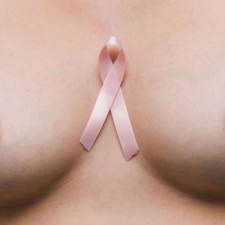 Breast Cancer Treatment