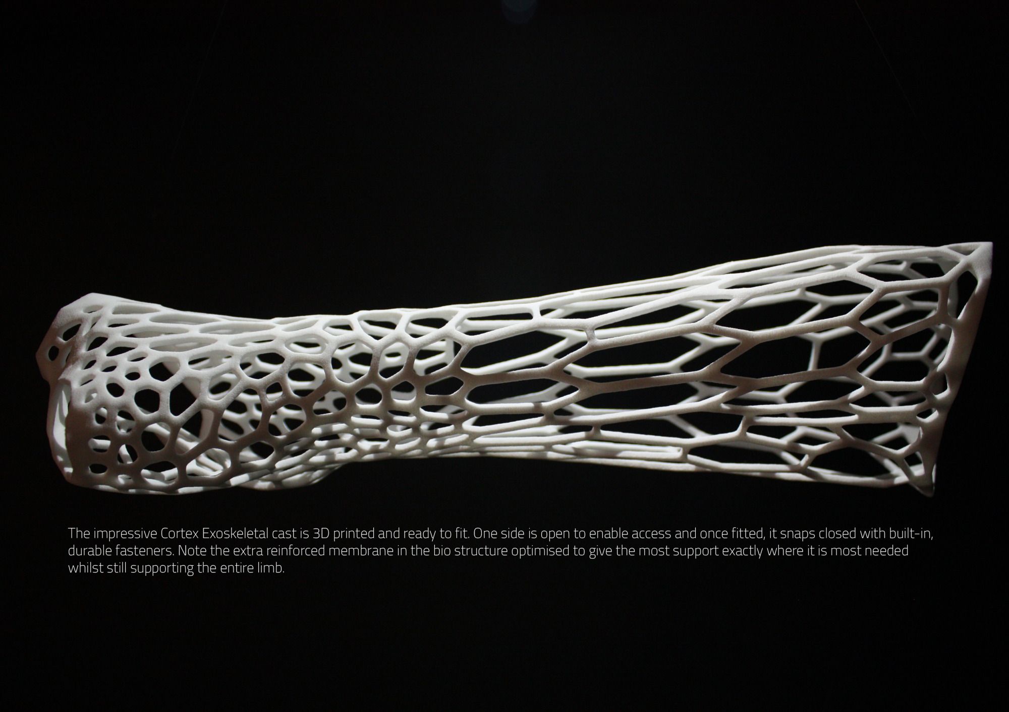 Cortex Exoskeletal Cast